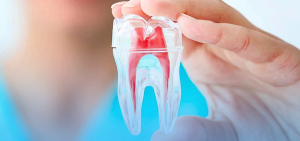 endodontia