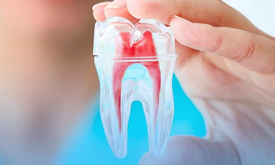 Endodontia: o que é e por que vale a pena se especializar?